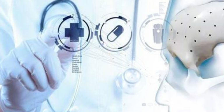 等离子清洗机在生物医用PEEK材料上的应用